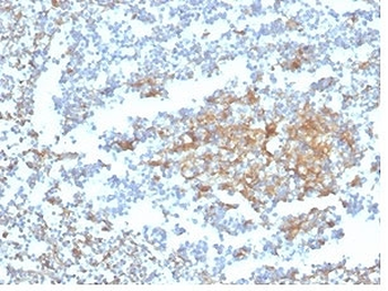 Vitamin D binding protein Antibody / VDBP / GC