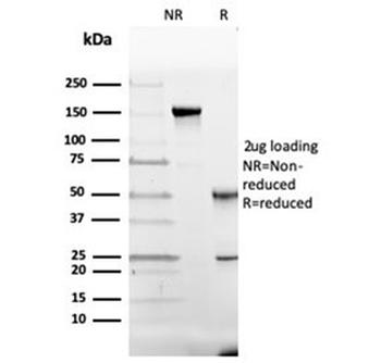 Vitamin D binding protein Antibody / VDBP / GC