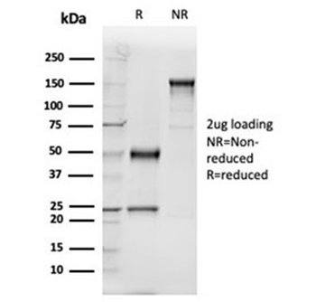 VDBP Antibody / Vitamin D binding protein / GC