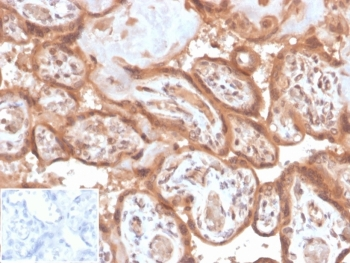 Fibroblast Activation Protein Alpha Antibody / FAP