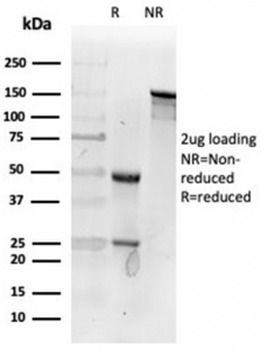 Fibroblast Activation Protein Alpha Antibody / FAP