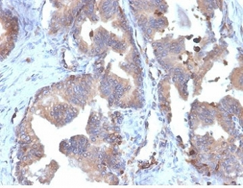 Recombinant Fatty Acid Binding Protein 5 Antibody / FABP5