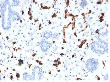 FABP4 Antibody / Fatty Acid Binding Protein 4