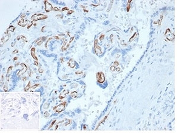 FABP4 Antibody / Fatty Acid Binding Protein 4