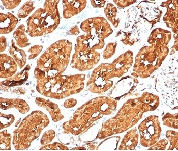 Recombinant Aldehyde Dehydrogenase 1A1 Antibody / ALDH1A1