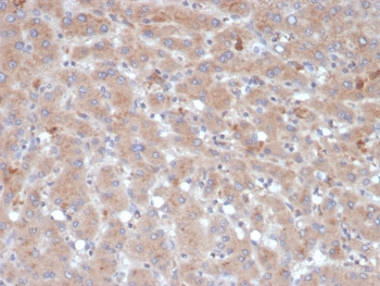Alpha-1-Antichymotrypsin Antibody / AACT / SERPINA3