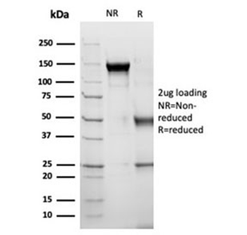 Alpha-1-Antichymotrypsin Antibody / AACT / SERPINA3