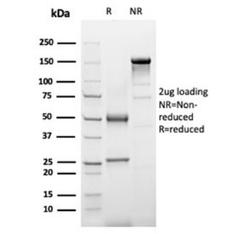 Alpha-1-Antichymotrypsin Antibody / AACT / SERPINA3