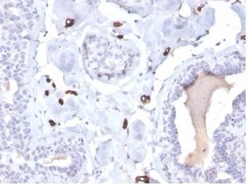 Fatty Acid Binding Protein 4 Antibody / FABP4