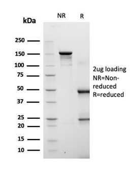 Fatty Acid Binding Protein 4 Antibody / FABP4
