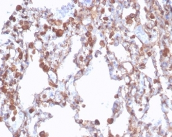 Recombinant ALDH1A1 Antibody / Aldehyde Dehydrogenase 1A1