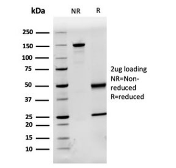 Fetuin-A Antibody / AHSG