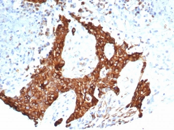 Recombinant Tubulin Beta Antibody / TUBB3