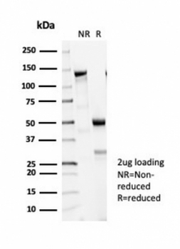 Recombinant Tubulin Beta Antibody / TUBB3