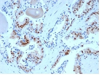 p27Kip1 Antibody / p27 / CDKN1B