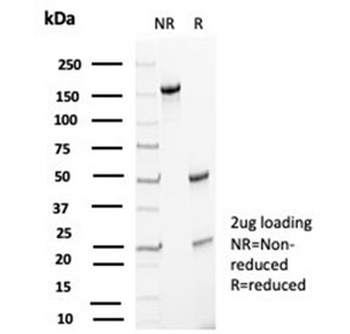 p27Kip1 Antibody / p27 / CDKN1B