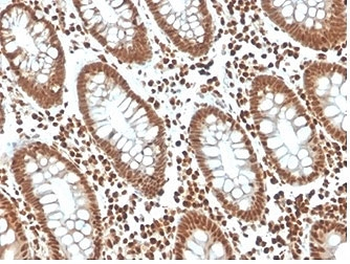 p27Kip1 Antibody / p27 / CDKN1B