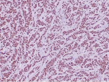 Integrase interactor 1 Antibody / INI1 / SMARCB1 / BAF47