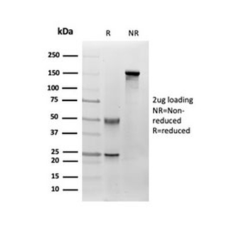 Fibroblast Activation Protein Alpha Antibody / FAP
