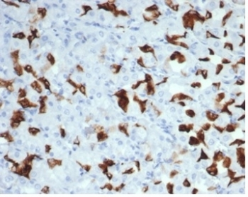 Recombinant MSH6 Antibody