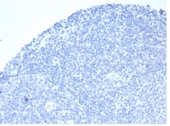 Recombinant ALPP Antibody / Placental Alkaline Phosphatase