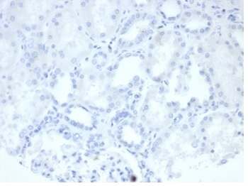 Recombinant ALPP Antibody / Placental Alkaline Phosphatase