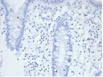 Recombinant ALPP Antibody / Placental Alkaline Phosphatase