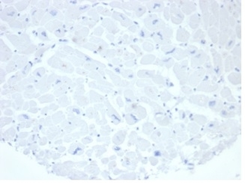 Recombinant ALPP Antibody / Placental Alkaline Phosphatase