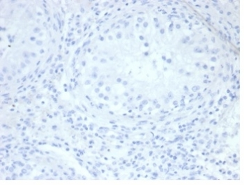 Recombinant ALPP Antibody / Placental Alkaline Phosphatase