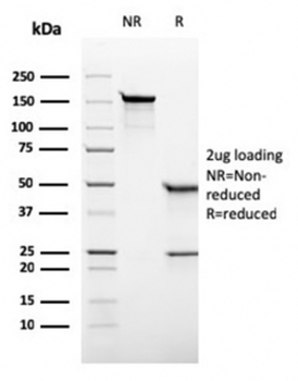 Recombinant ALPP Antibody / Placental Alkaline Phosphatase