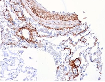 Fibroblast Growth Factor 21 Antibody / FGF21