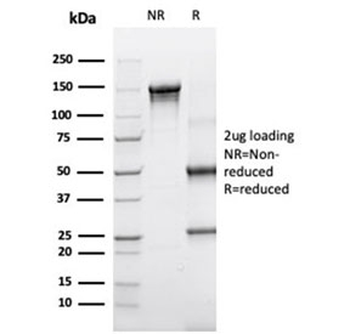 SERPINA3 Antibody / AACT / Alpha-1-Antichymotrypsin