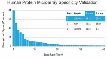 SERPINA3 Antibody / AACT / Alpha-1-Antichymotrypsin