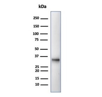 CD20 Antibody