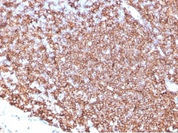 CD20 Antibody