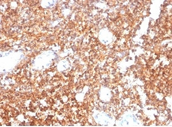 CD20 Antibody