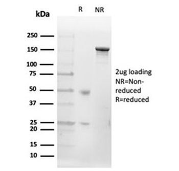 CD20 Antibody