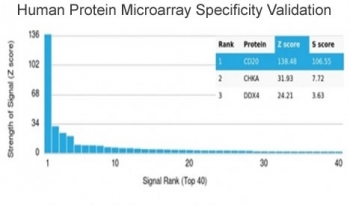 CD20 Antibody