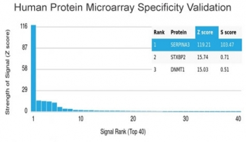 Alpha-1-Antichymotrypsin Antibody / AACT / SERPINA3