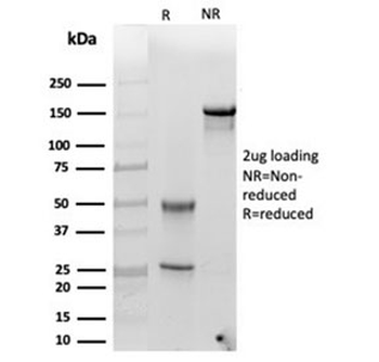 Alpha-1-Antichymotrypsin Antibody / AACT / SERPINA3