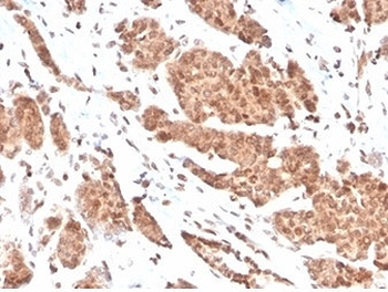 NME1 Antibody / NM23
