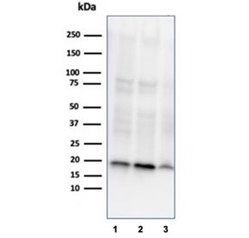 NME1 Antibody / NM23