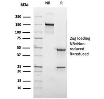 GCSAM Antibody / HGAL / GCET2