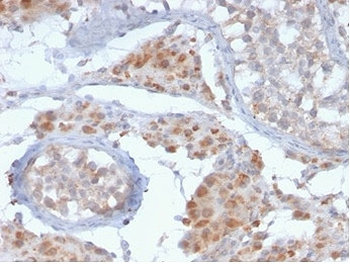 GCSAM Antibody / HGAL / GCET2