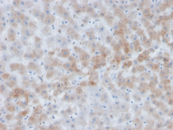 AACT Antibody / Alpha-1-Antichymotrypsin / SERPINA3