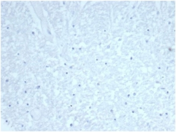 Recombinant Cdc20 Antibody