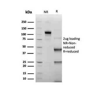 Transcriptional regulator ERG Antibody / ERG