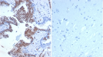 Transcriptional regulator ERG Antibody / ERG