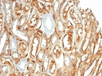 Recombinant CD59 Antibody