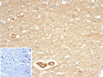 Recombinant CD59 Antibody